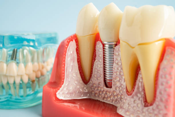 TMJ/TMD Treatment